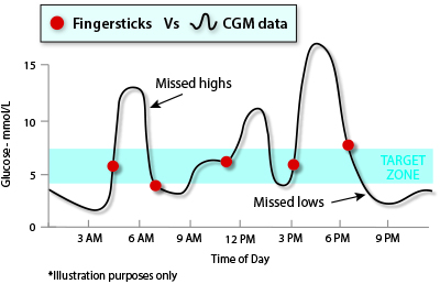 How much does an insulin pump cost How much does an insulin pump cost