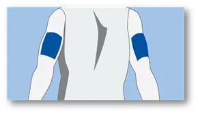 Guardian™ 4 sensor insert locations