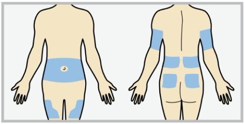 Insertion site