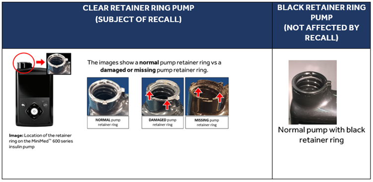 Retainer ring location