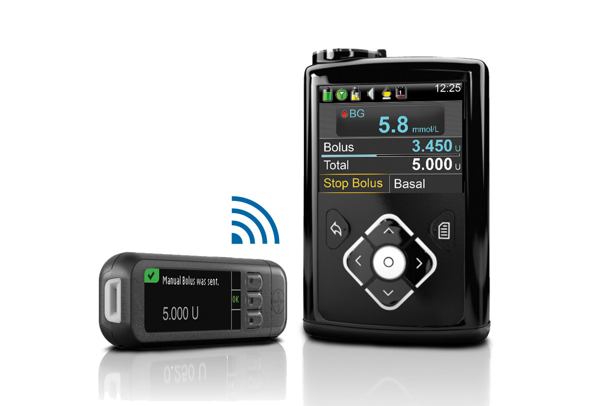 SmartGuard Predicting hypos Continuous Glucose Monitoring