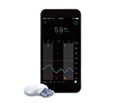 Blood Glucose Monitor