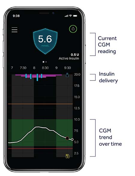 MiniMed App