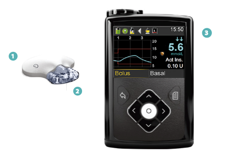 Medtronic Glucose Sensor | Sensor and Transmitter Support – ECGZCE